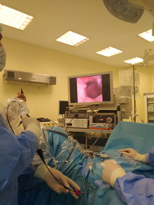 Video nasal endoscope/endoscope vagina