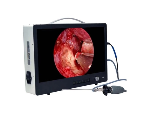 Portable Full HD Endoscope Camera For ENT Laparoscopy Hysteroscopy Cystoscopy Surgery Equipment