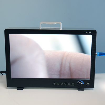 Portable Full HD Endoscope Camera For ENT Laparoscopy Hysteroscopy Cystoscopy Surgery Equipment
