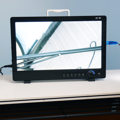 Portable Full HD Endoscope Camera For ENT Laparoscopy Hysteroscopy Cystoscopy Surgery Equipment