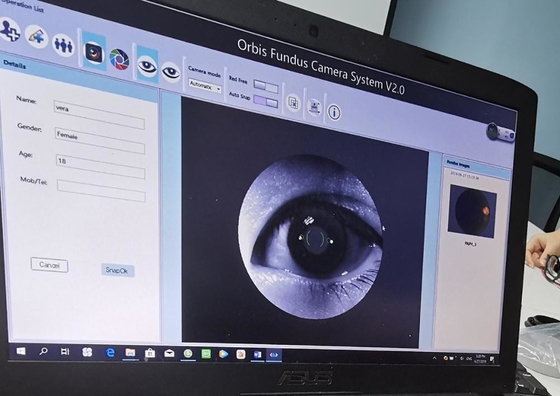 factory price for the auto Capture and Auto Flash Fundus Camera for Retinal Examination