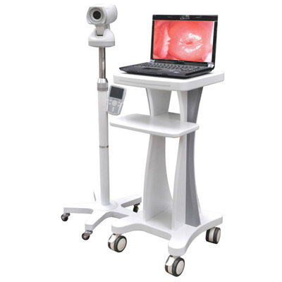 Professional Video Colposcope Endoscope Gynaecology Colposcope CE03