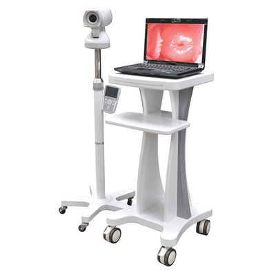 Professional Video Colposcope Endoscope Gynaecology Colposcope CE03