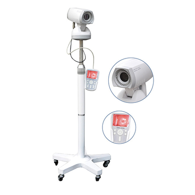 Professional Video Colposcope Endoscope Gynaecology Colposcope CE03