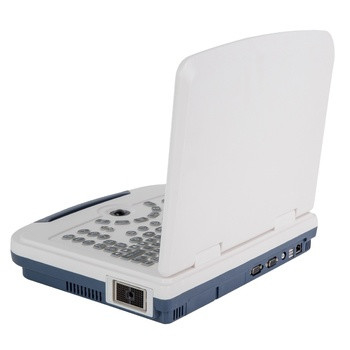 ON SALE!!!  Portable full digital laptop B&W ultrasound scanner for hospital