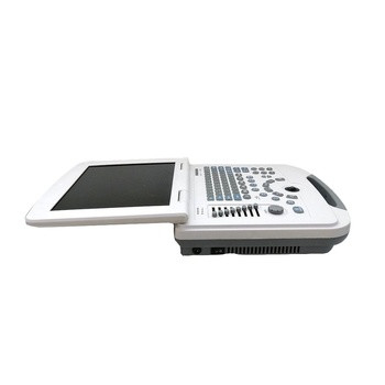 ON SALE!!!  Portable full digital laptop B&W ultrasound scanner for hospital