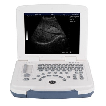 ON SALE!!!  Portable full digital laptop B&W ultrasound scanner for hospital