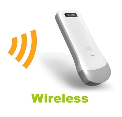 Wireless ultrasound probe iphone ultrasound probe uprobe-2(Convex) with ISO and CE