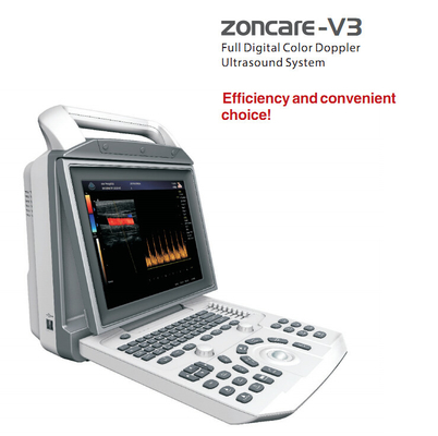 ZONCARE-V3 Portable Digital color Doppler ultrasound machine with CE