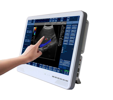 low price SU-6C Color Doppler Ultrasound System(Touch Screen) with CE certificates