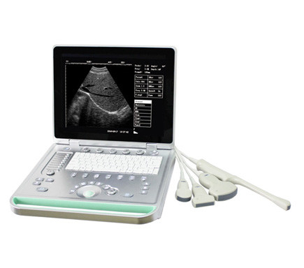 Portable ultrasound machine Laptop Ultrasound machine SU-7S with CE