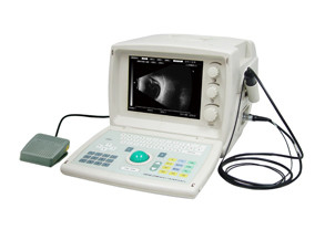 ODM-2100S Low price stable quality Opthalmology Ultrasonic A/B Scanner with ISO, CE