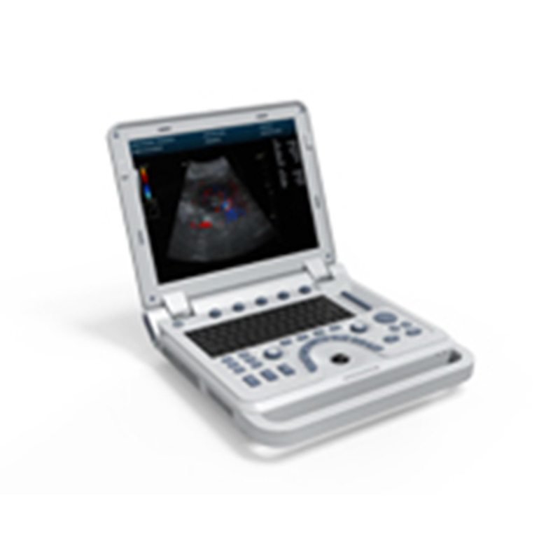 CONTEC CMS600P2 PLUS  portable ultrasound machine pseudo color doppler medical  ultrasound Pulse Spectral Doppler instru