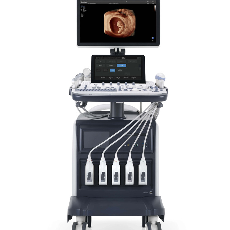 Sonoscape S60 Ecografo Sonoscape Ultrasound Machine Cw Tdi Software For Free
