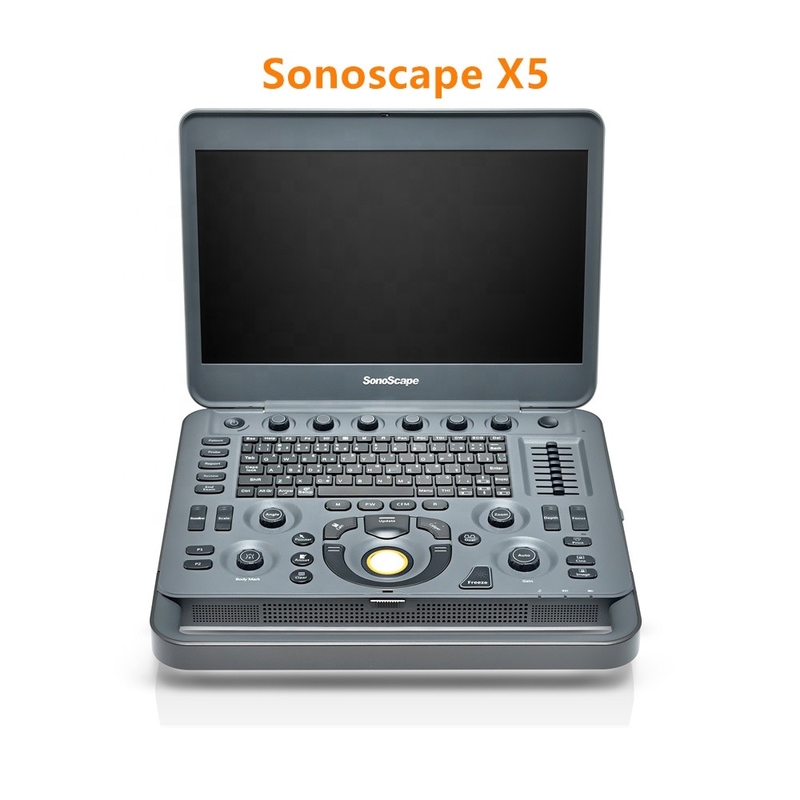 Sonoscape X5 Medical Ultrasound Instruments Machine with Excellent Image Quality