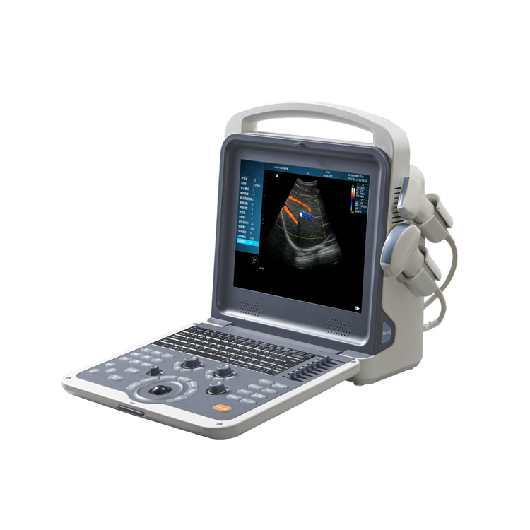 Factory price color doppler portable ultrasound scanner