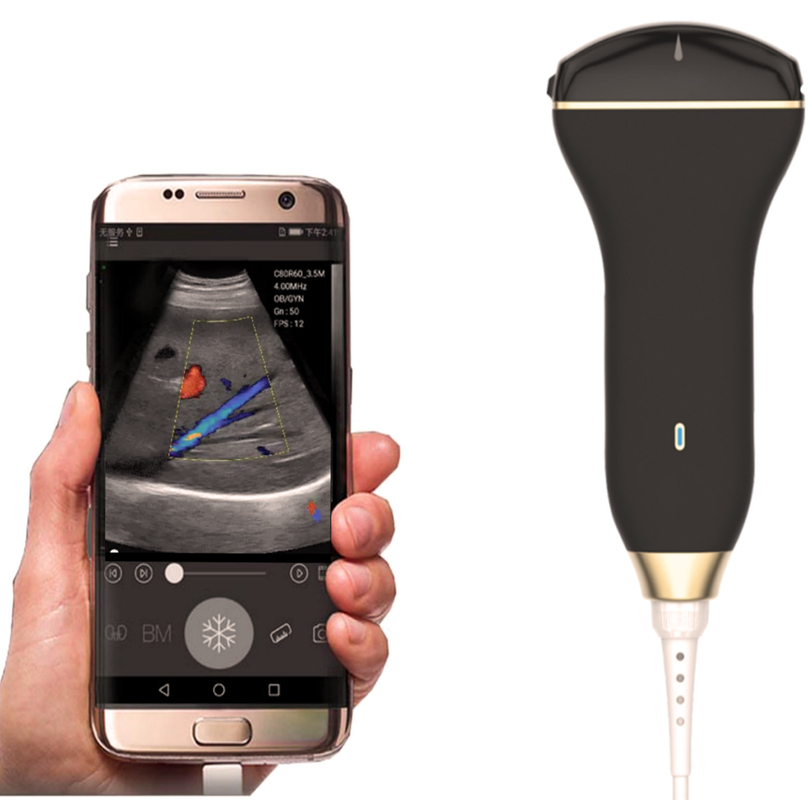 Mobile Smart USB Color Doppler Ultrasound Probe For Laptop