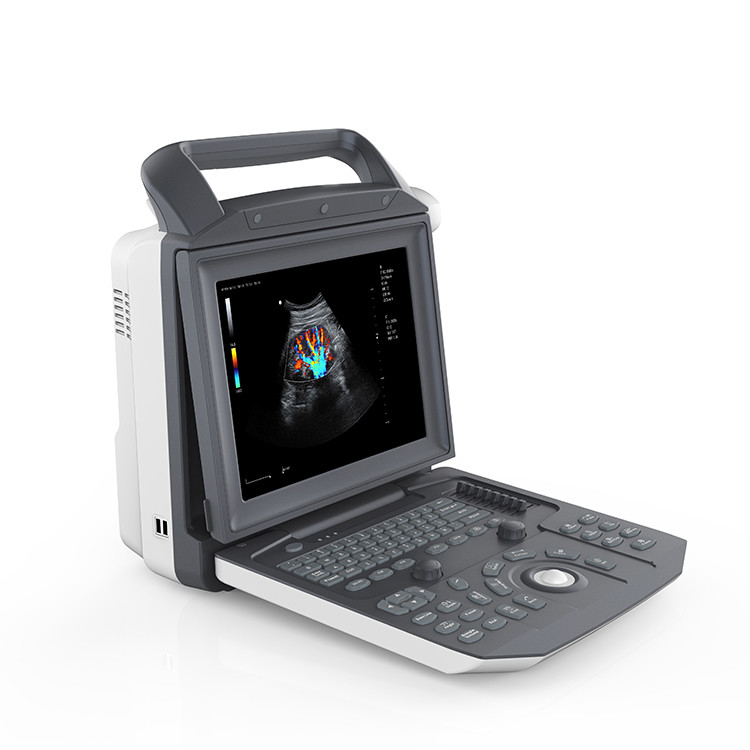 Portable Full Digital Color Doppler Ultrasound System Medical Scanner Ultrasound