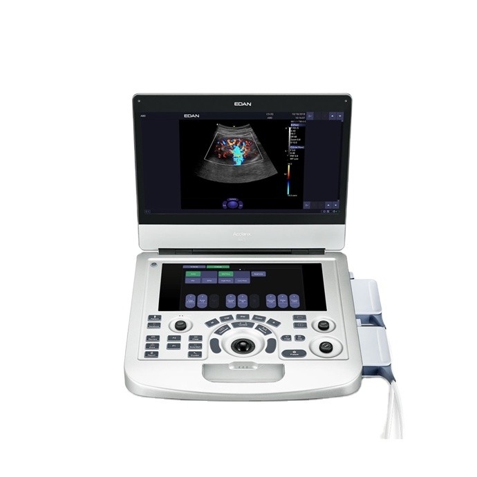 Color Ultrasound Machine Obstetrics And Gynecology Equipment 17MHz Linear Probe
