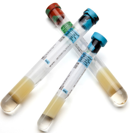 Prp Tube Platelet Rich Plasma 10ml 15ml Disposable Medical Consumables CE