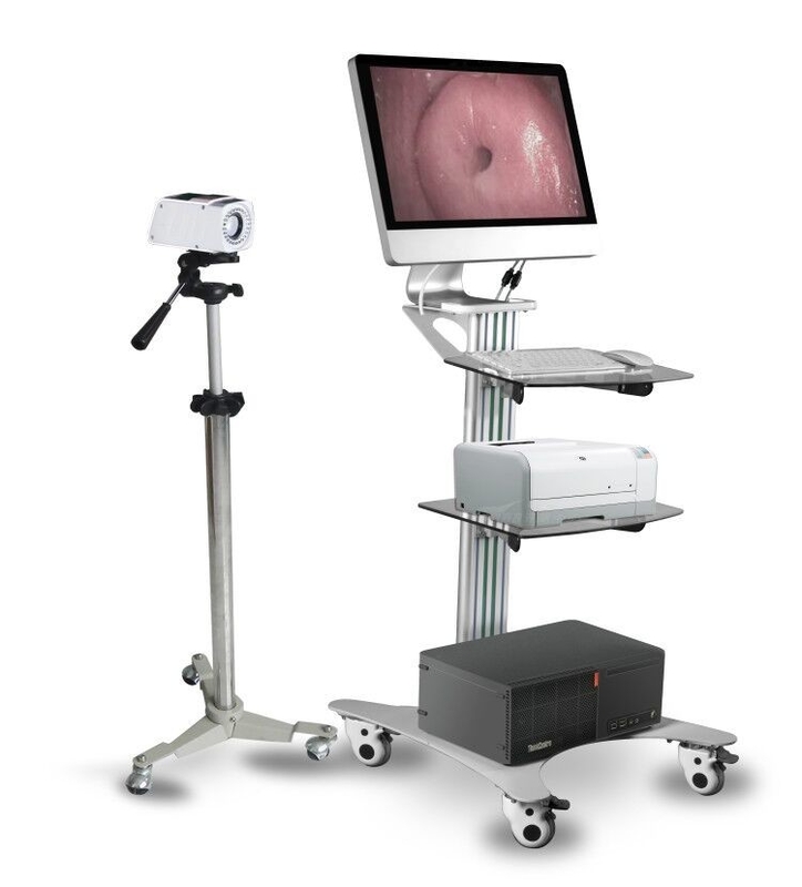 Advanced Trolley type Digital Electronic video Colposcope for vagina Gynecological examination CE20