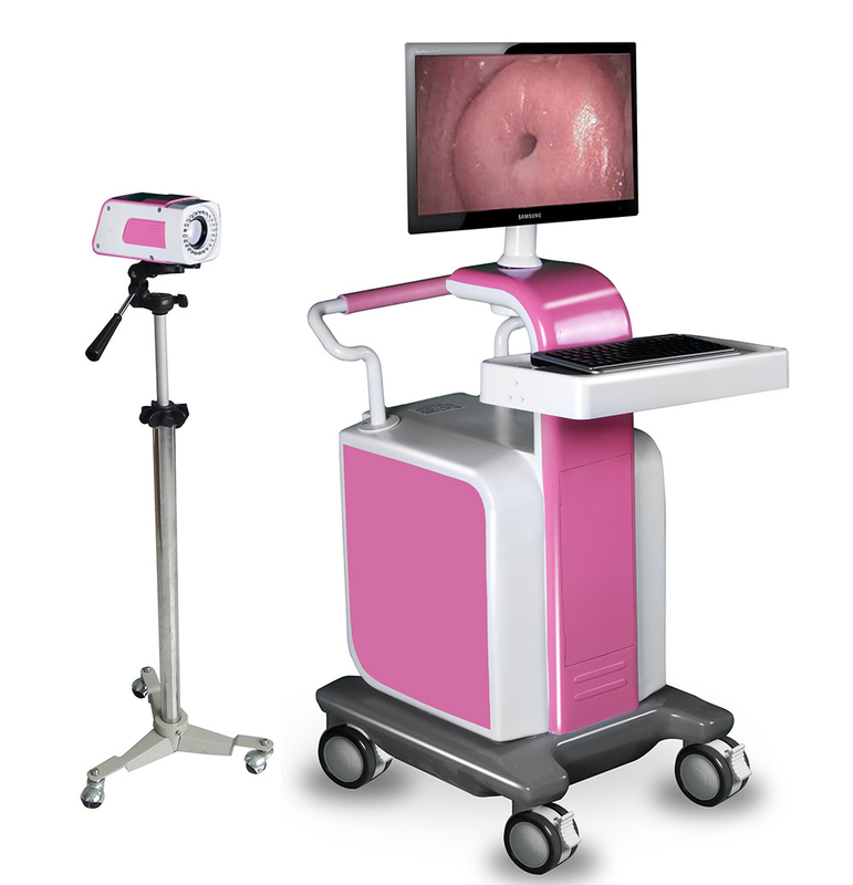 Digital Video Colposcope for hospitals