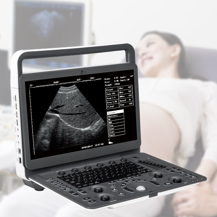 Sonoscape E2 Ecografo Cardiac Vascular Diagnosis B/ 2B/ 4B/ M/ Color Doppler Ultrasound Machine Requipo De Ultrasonido